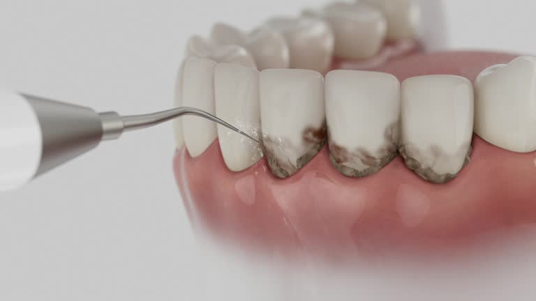 Reliable Dental Implants contractor in Center Point, TX by Smile Center Dentistry